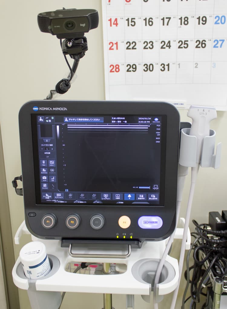 超音波検査機器